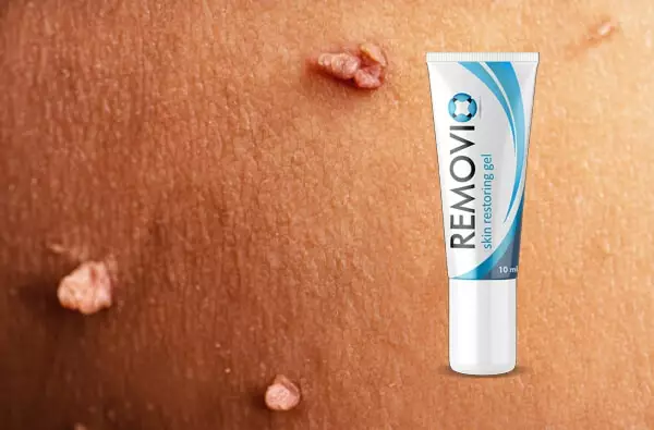 Kaj je gel Removio?